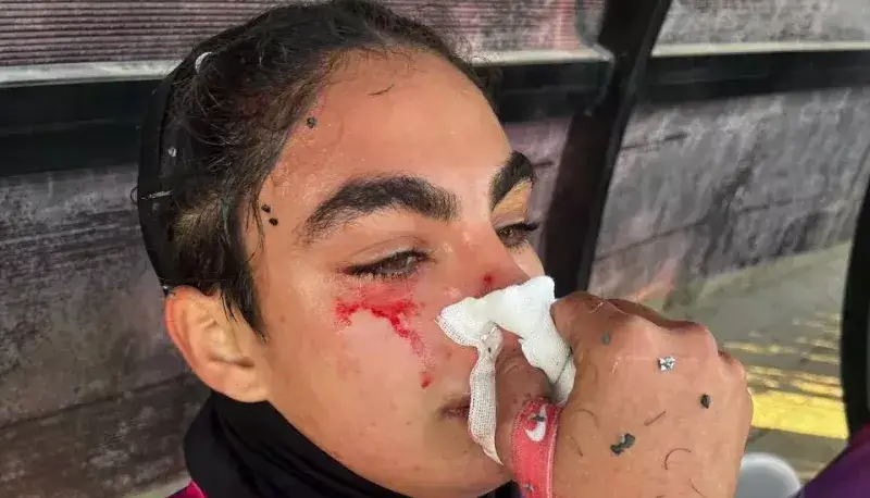 ماجرای عکس خونین در بازی زنان پرسپولیس!