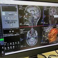 تجهیز نرم افزارهای پیشرفته واحد MRI بیمارستان سینا به همت خانواده یک خیر سلامت