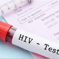 آخرین وضعیت واکسن HIV / انگ اجتماعی بزرگ‌ترین مانع در کنترل این بیماری