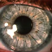 چشم انسان رو هزار برابر زوم کنید وارد یه دنیای دیگه میشید!