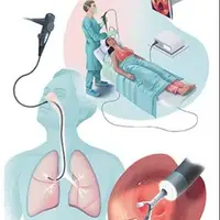 معنای واژه «اسکوپی» در علم پزشکی چیست؟