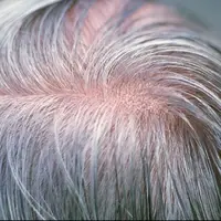 آیا می‌توان جلوی سفید شدن موها را گرفت؟