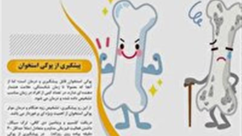 ابتلای زنان به پوکی استخوان، بیشتر از مردان