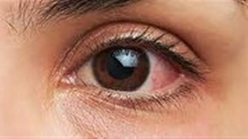 چگونه چشم هایمان را در خانه معاینه کنیم؟