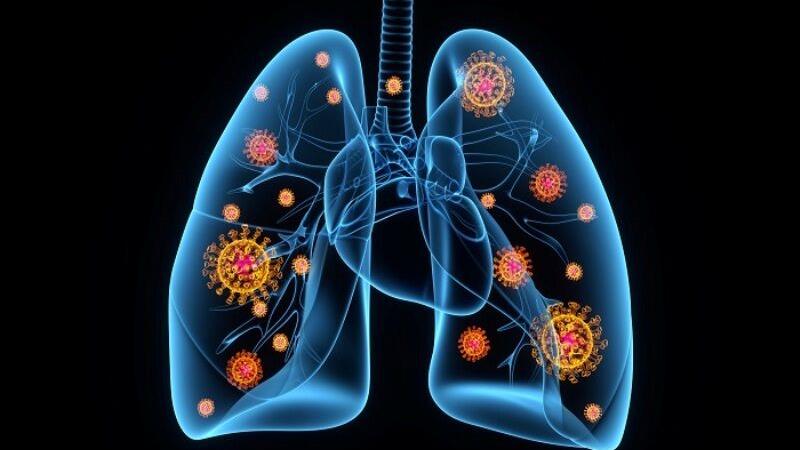 ذاتالریه(پنومونی) همچنان یک تهدید جدی برای کودکان و سالمندان است