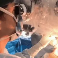 جراحی تومور مغزی کودک ۱۰ ساله در حالت بیداری