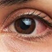 چگونه چشم هایمان را در خانه معاینه کنیم؟