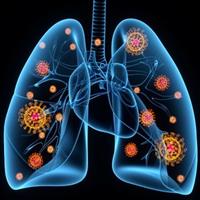 ذات‌الریه(پنومونی) همچنان یک تهدید جدی برای کودکان و سالمندان است