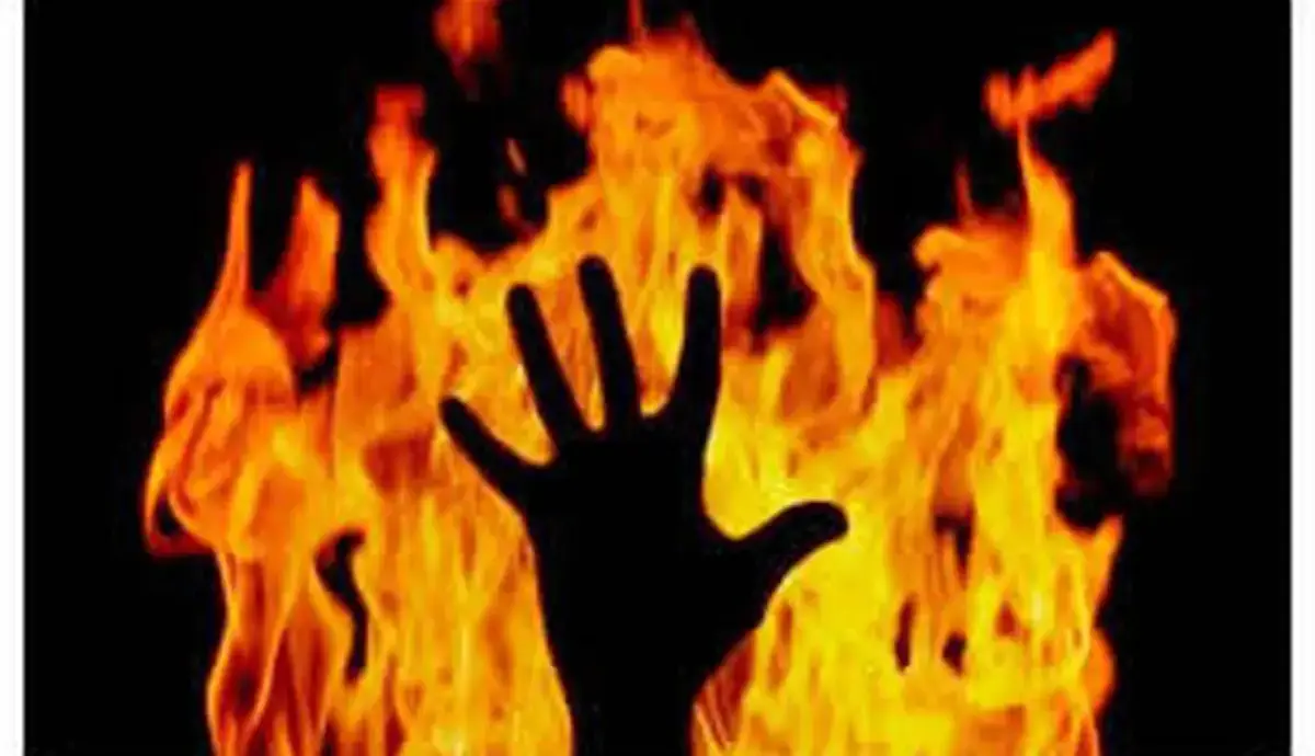 بستری شدن یکی از نیروهای آتش نشانی سنندج در بیمارستان بر اثر خودسوزی