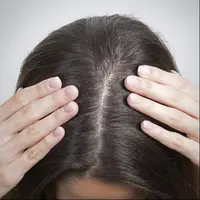  نسخه شخصی دکتر برای پر پشتی مو!