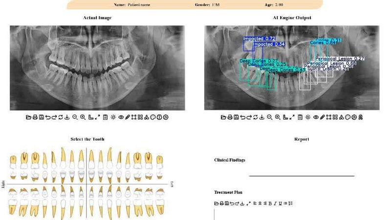 توسعه سامانه هوشمند تحلیل تصاویر دندانپزشکی در دانشگاه تهران