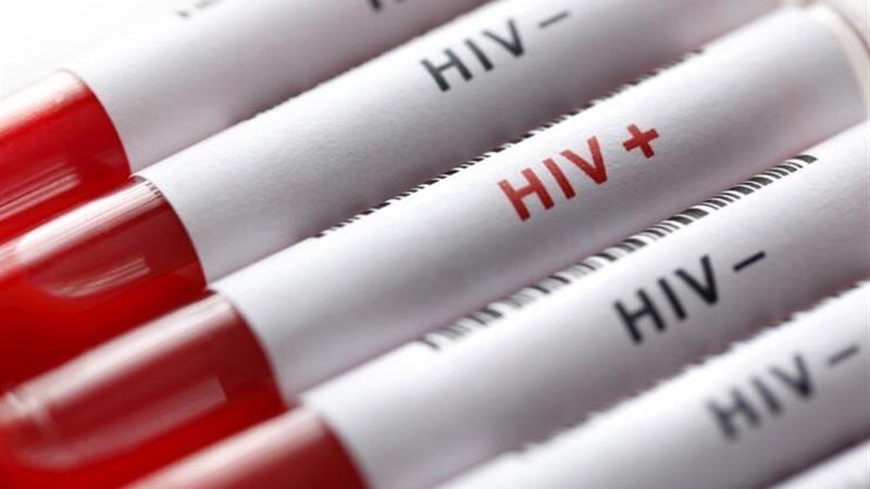 «مصرف تفننی مواد» و «رفتارهای جنسی پرخطر» عامل اصلی افزایش ریسک HIV