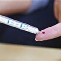 انجام آزمایش رایگان اچ آی وی در چهار مرکز تخصصی البرز