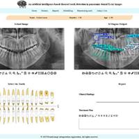 توسعه سامانه هوشمند تحلیل تصاویر دندانپزشکی در دانشگاه تهران