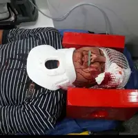 برخورد پراید و پژو در محور نطنز - کاشان با ۱۰ مصدوم