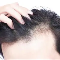 ترفند قدرتمند تقویت ریشه مو!