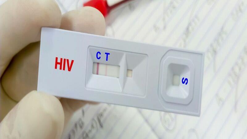 شناسایی ۲۴۹ بیمار مبتلا به اچآیوی در کردستان
