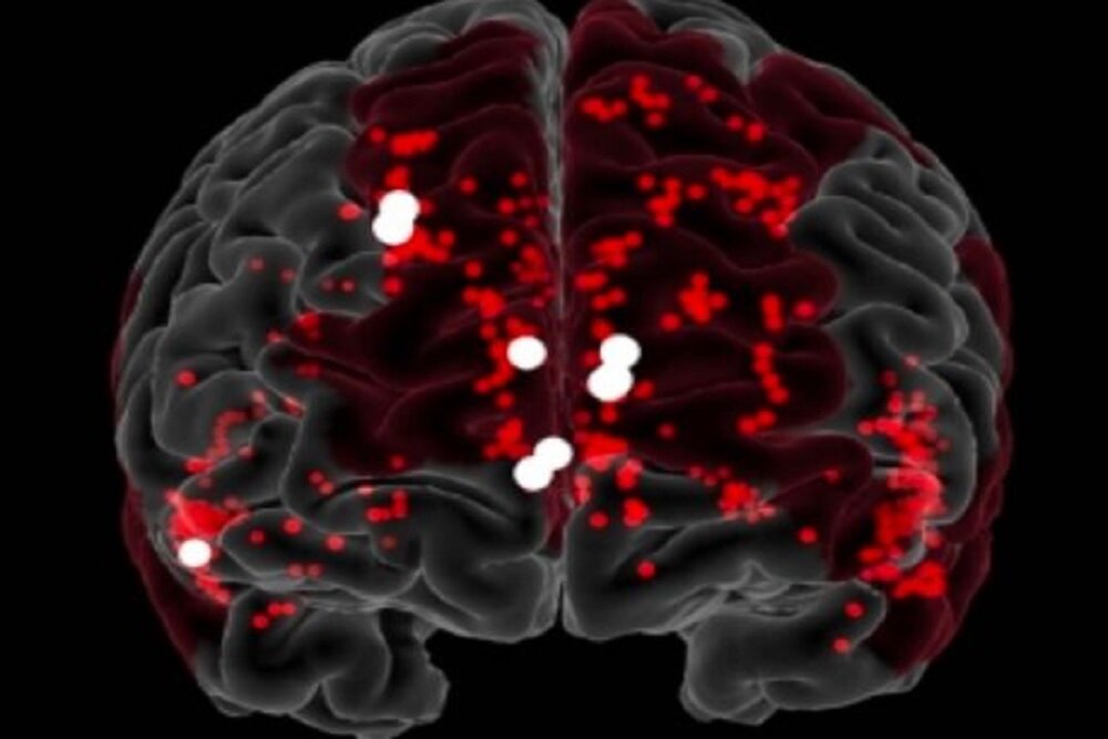 نانورباتها با موفقیت خونریزی مغز را متوقف کردند