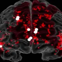 نانورباتها با موفقیت خونریزی مغز را متوقف کردند