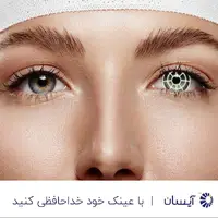 حذف عینک با پیشرفتهترین تکنولوژی روز دنیا؛ درچند ثانیه با عینک خداحافظی کنید