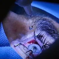 ردپای یک پزشک و مقام سابق مشهور در انجام جراحی ممنوعه