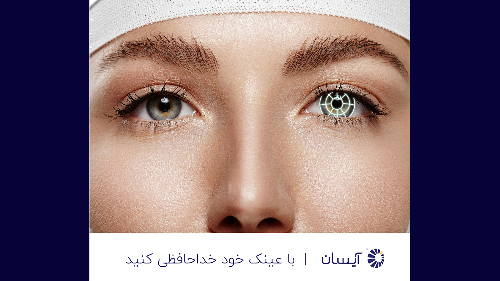 حذف عینک با پیشرفتهترین تکنولوژی روز دنیا؛ درچند ثانیه با عینک خداحافظی کنید