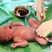 امید تازه برای درمان فلج مغزی کودکان و آرتروز