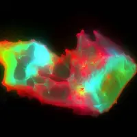 کشف ساختارهای عجیب و غریب در خون افراد مبتلا به کووید طولانیمدت