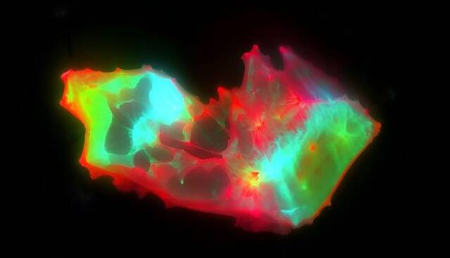 کشف ساختارهای عجیب و غریب در خون افراد مبتلا به کووید طولانیمدت