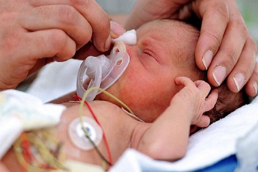 ۱۰/۵ درصد از نوزادان همدان نارس هستند!