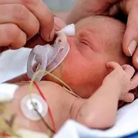 ۱۰/۵ درصد از نوزادان همدان نارس هستند!