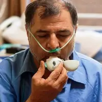 وجود 60 هزار جانباز شیمیایی در کشور