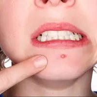 جوشها را دستکاری نکنید