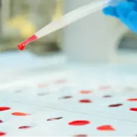 خون طلایی؛ فقط ۵۰ نفر صاحب نادرترین گروه خونی دنیا هستند