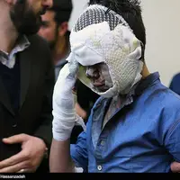 افزایش آمار سوختگی در اصفهان