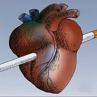 پژوهش تکاندهنده: ۱۰۰ نخ سیگار در طول عمر کافی است تا قلب را آسیبپذیر کند