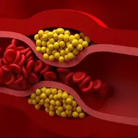 جادهصافکنهای «کلسترول بد»