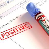 انگ اجتماعی مانع درمان حاملان مبتلا به ایدز