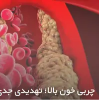 چربی خون بالا؛ تهدیدی جدی برای سلامت جامعه 