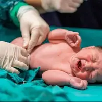 کاهش اضطراب و ترویج زایمان طبیعی با «حضور همسر در اتاق زایمان»