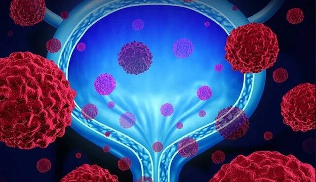 نقش مواد پروبیوتیک در عفونتهای ادراری زنان