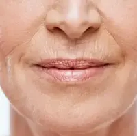 تکنیک‌های جدیدی که برای از بین بردن چین و چروک صورت استفاده می‌شود