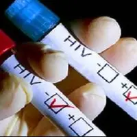 HIV دیگر پایان زندگی نیست، اگر زود تشخیص داده شود