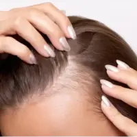 مقصر اصلی ریزش موی ناشی از استرس بالاخره شناسایی شد