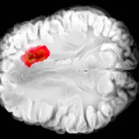 کشف دارویی برای مبارزه با کشنده‌ترین سرطان‌های مغز