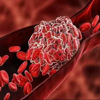 چربی خون بالا؛ دشمن خاموش رگها