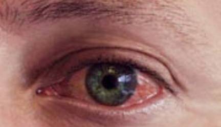 آلودگی هوا با چشم‌ها چه می‌کند؟