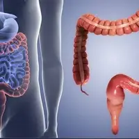 افزایش انسداد گوارشی ناشی از مصرف بی‌رویه «انار» و «خرمالو» در کودکان