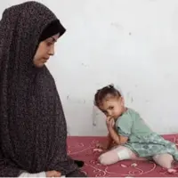 قطع عضو ۶ هزار تن از مردم غزه در جنگ اسرائیل