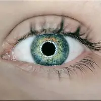 بازگشت بینایی یک بیمار با قرنیه چاپ سهبعدی